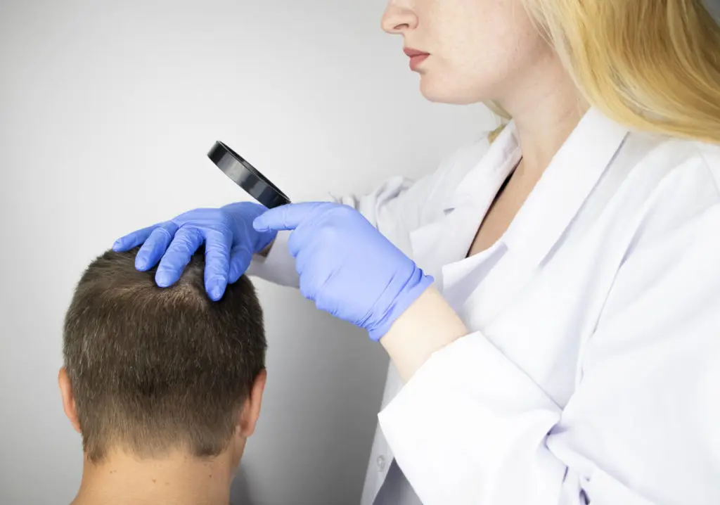 the DHT hormone is the main reason causing hair follicles to die out