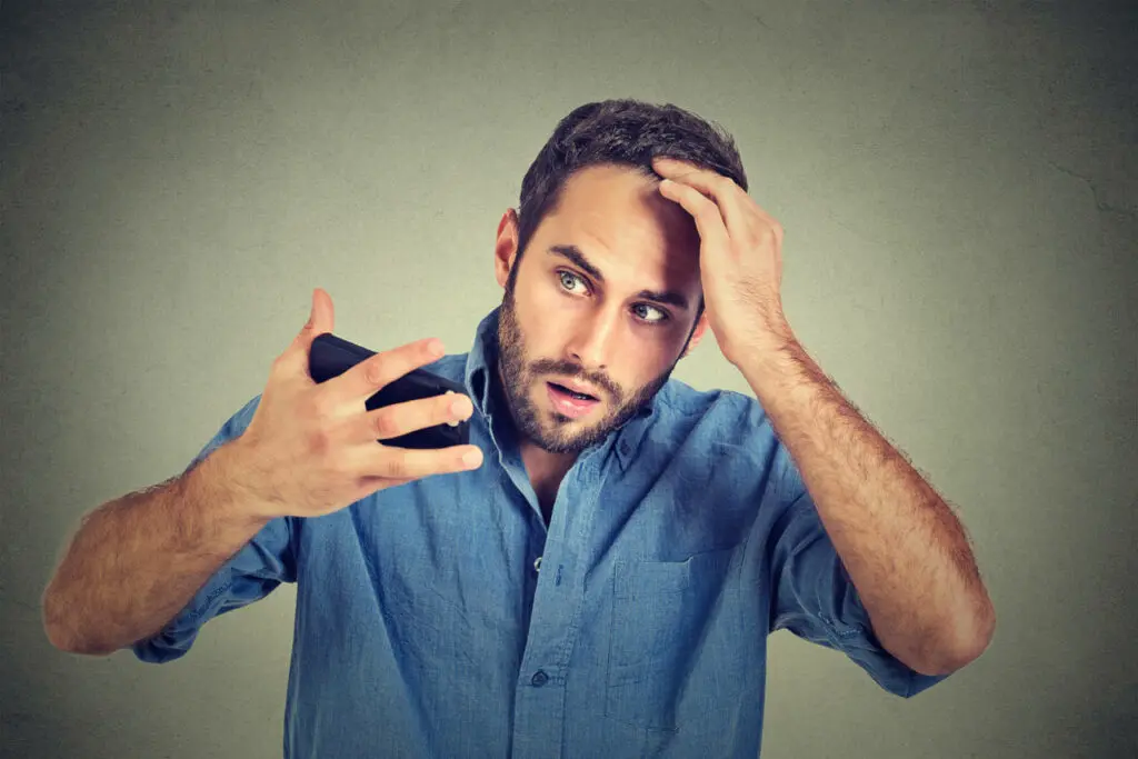 A distressed man suffering from androgenetic alopecia examines his receding hairline in the front-facing camera of his phone.