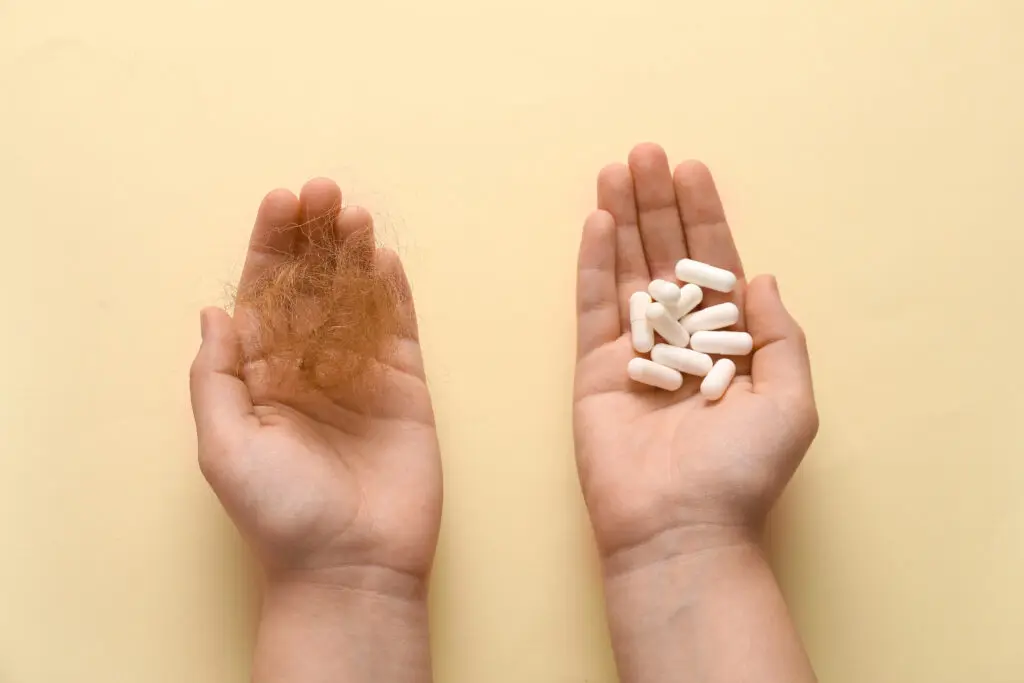 A person holding a clump of shed hair in one hand and MSM pills in the other.