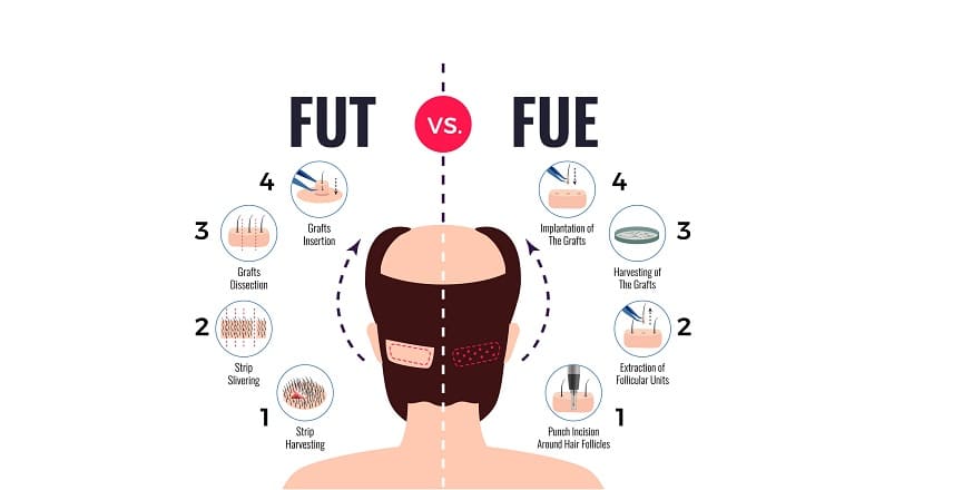 What are the differences between fue and fut ?