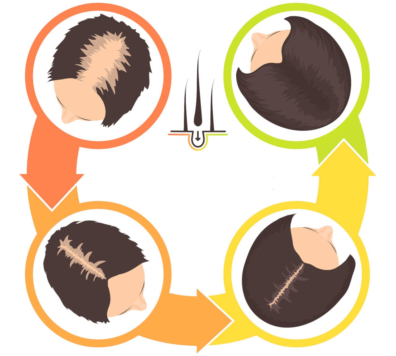 what can trigger a hair loss after a surgery