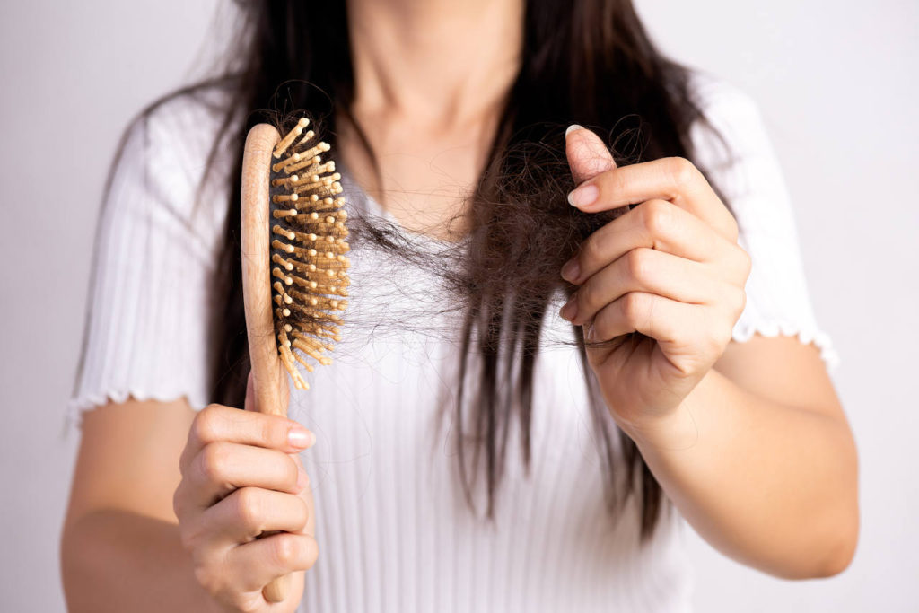 is hair loss common for women