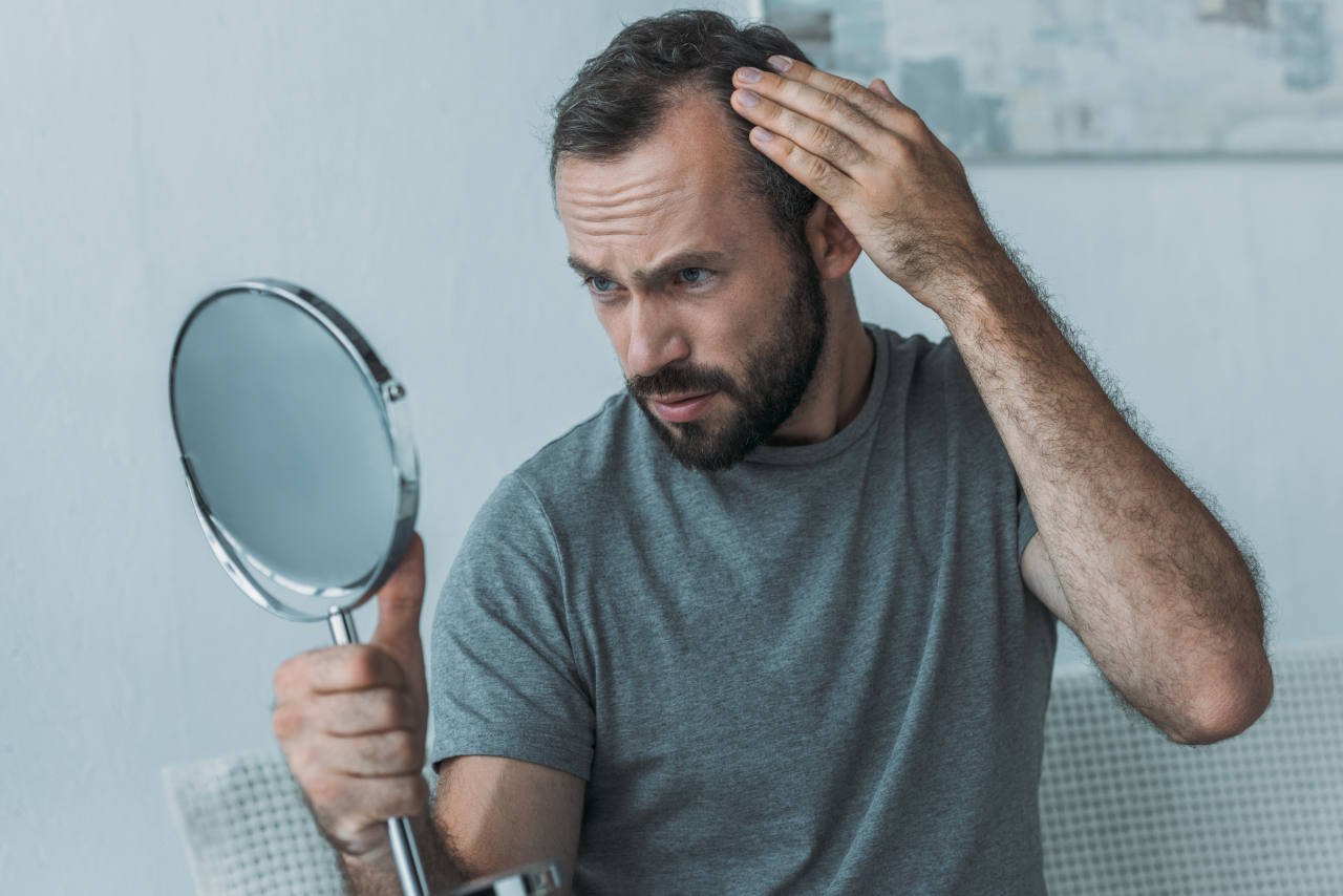 men looking at his hair loss in a mirror