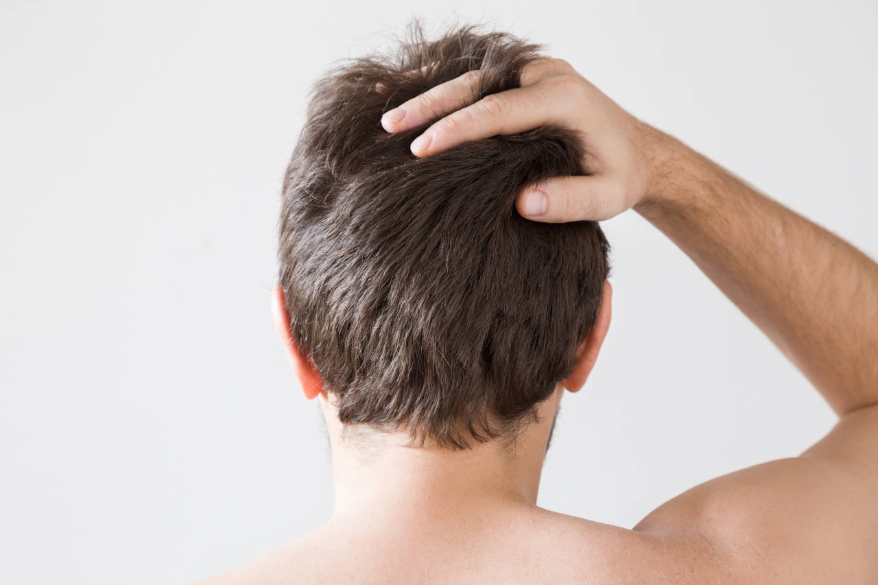 Men wondering what has caused his dry hair