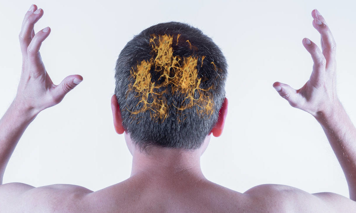 Itchy Scalp And Hair Loss Could There Be A Connection  Kintsugi Hair