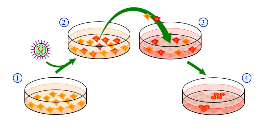 the stem cell hair transplant explained with Elithairtransplant