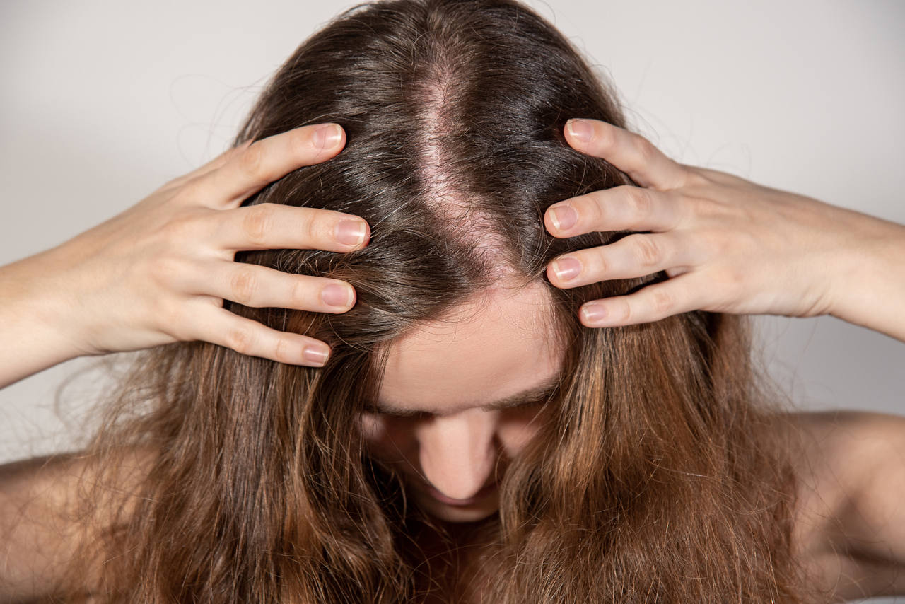 discover the causes and treatments for hair loss in women