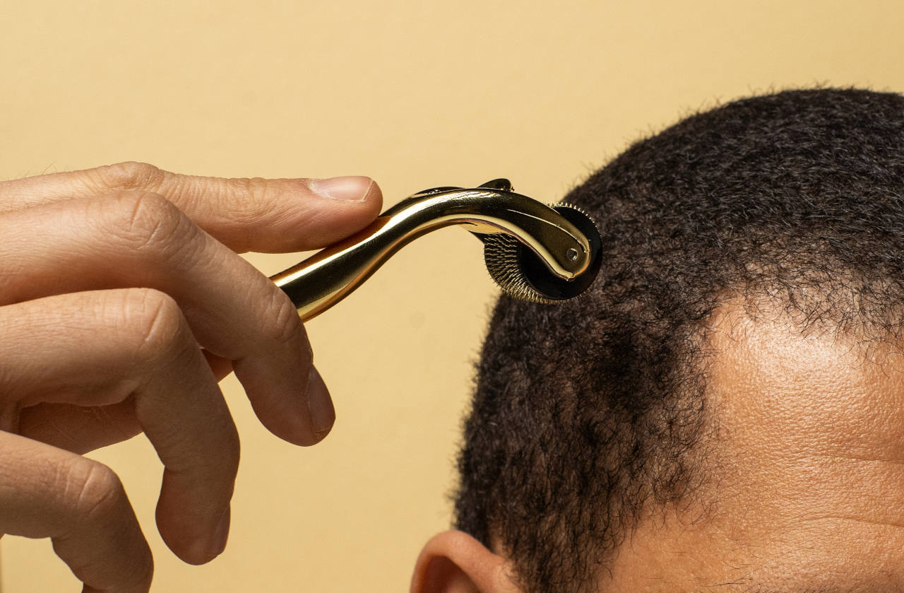 A man using a dermaroller on his head for a mesotherapy hair treatment