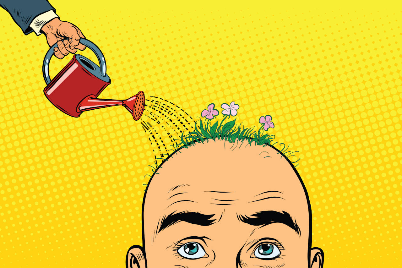 Illustration of a man getting his head watered to regrow lost hair