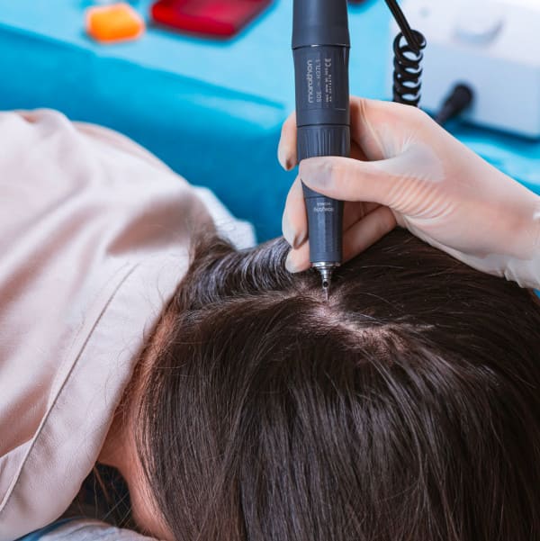 Elithair hair surgeon extracting the hair grafts using the FUE method