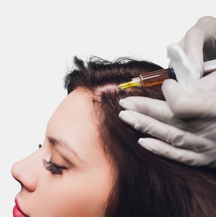 Woman receiving a PRP injection before hair restoration treatment