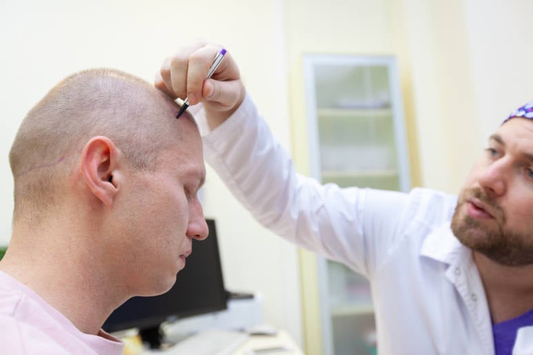 Image showing a doctor analysing the best treatment for alopecia areata
