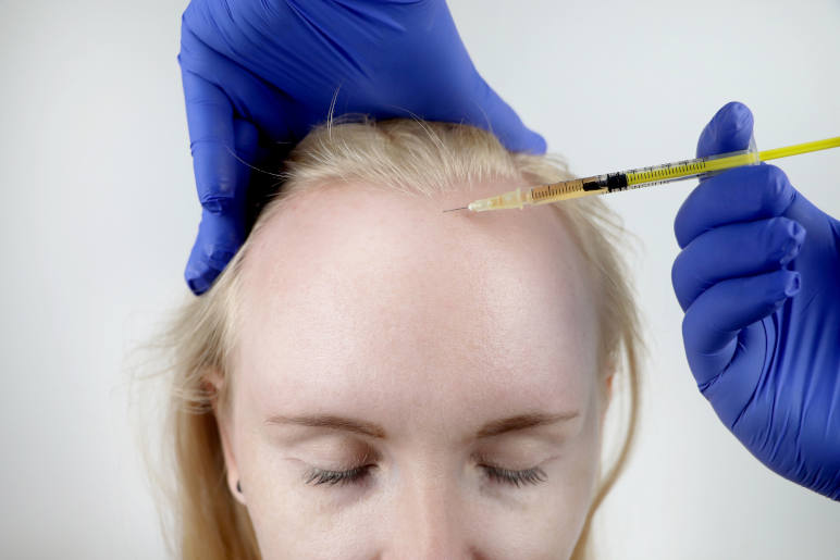 A woman having a steroid injection to treat her frontal fibrosing alopecia