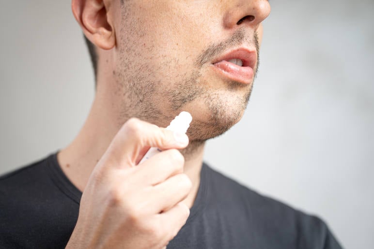 A-man-applying-a-beard-alopecia-treatment