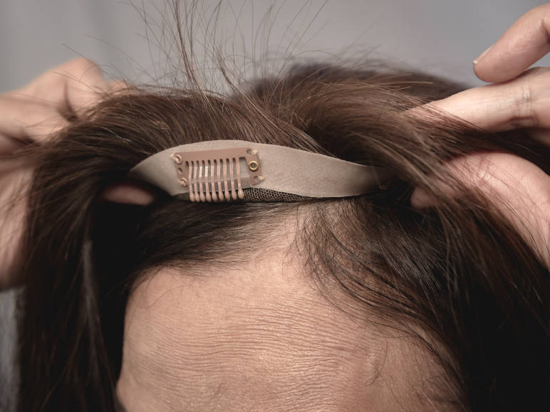 a woman fixing a wig over her alopecia