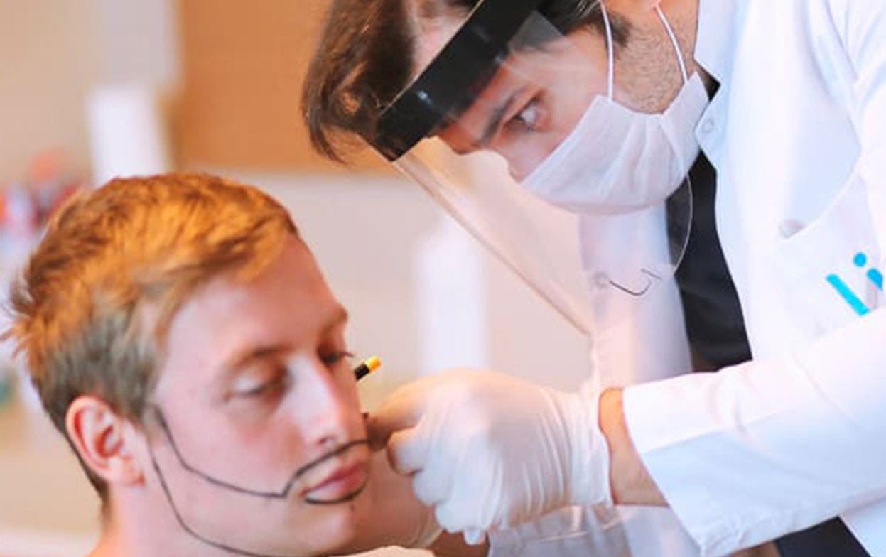 Dr. Balwi drawing a patient's beard before his beard transplant operation at Elithair.