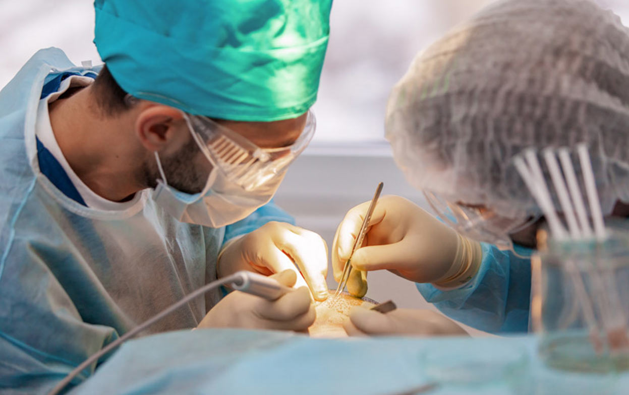 Elithair medical team performing a FUE hair transplant operation