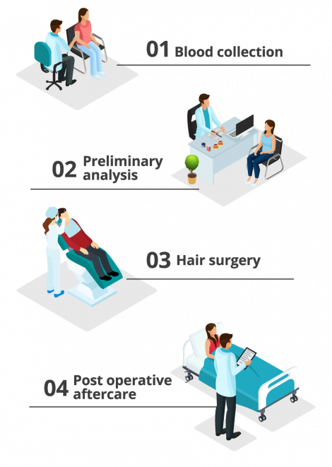 Infographic showing the 4 steps of a hair transplant procedure in Turkey