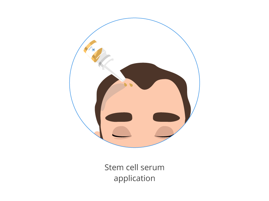 infograhic showing the stem cell serum application