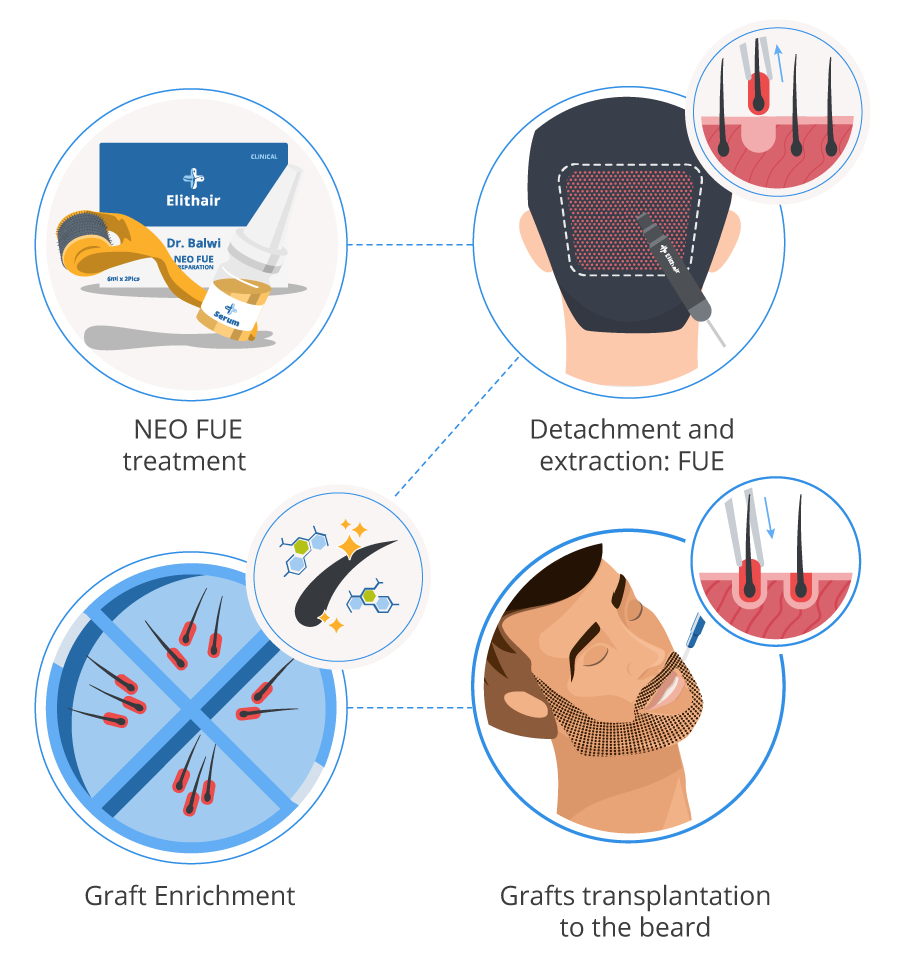 beard infographic