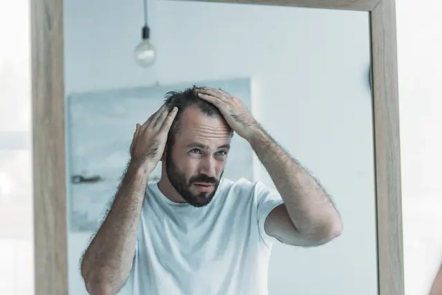 image of a men looking at the stage of his hair loss