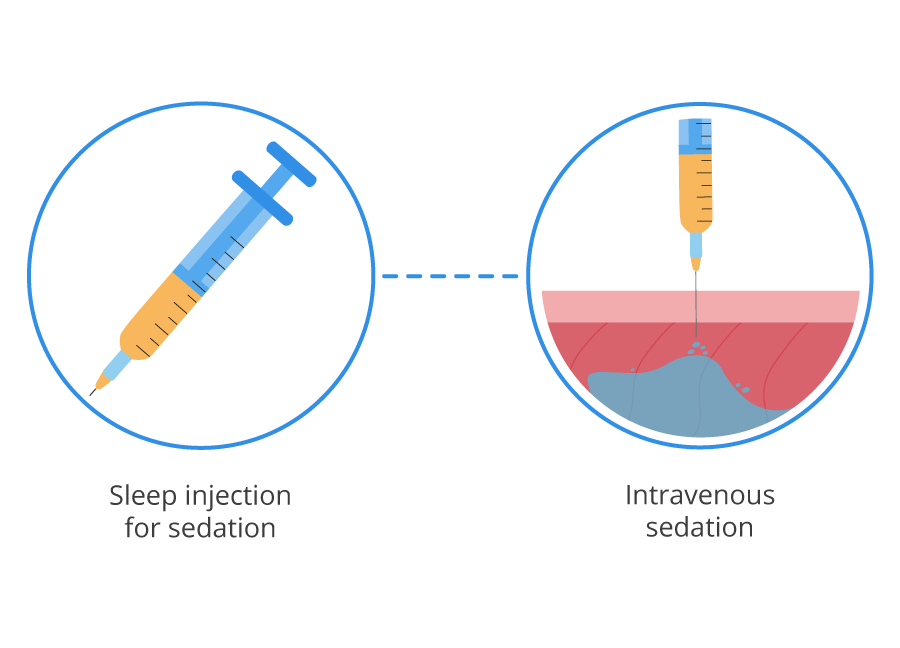 Infographic sleep injection for sedation