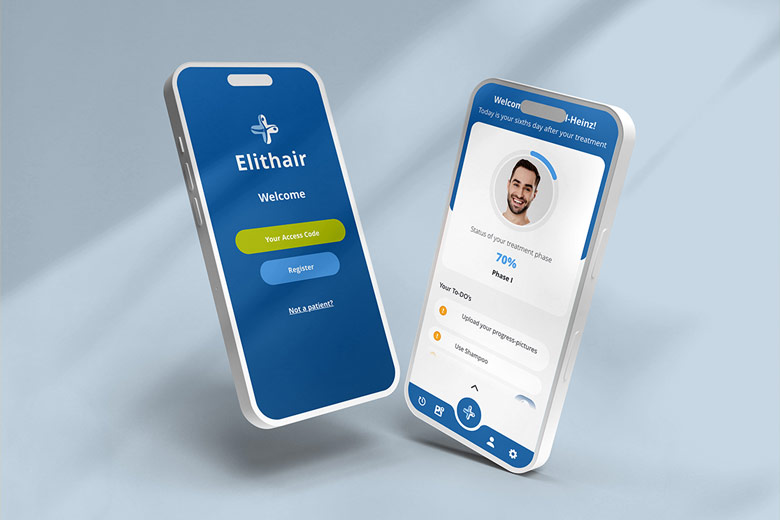 The profile screens of the Elithair Hair Transplant App