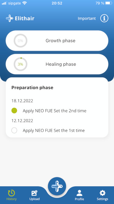 The control phase in the Elithair App