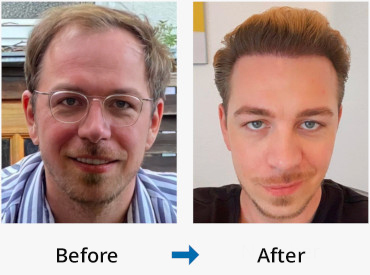 Tobias P Before and After