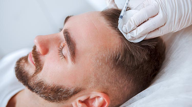 Male patient getting a PRP treatment after the hair transplant