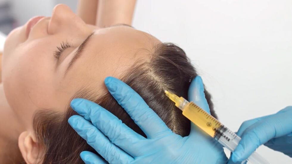 Female patient get a PRP hair treatment injection