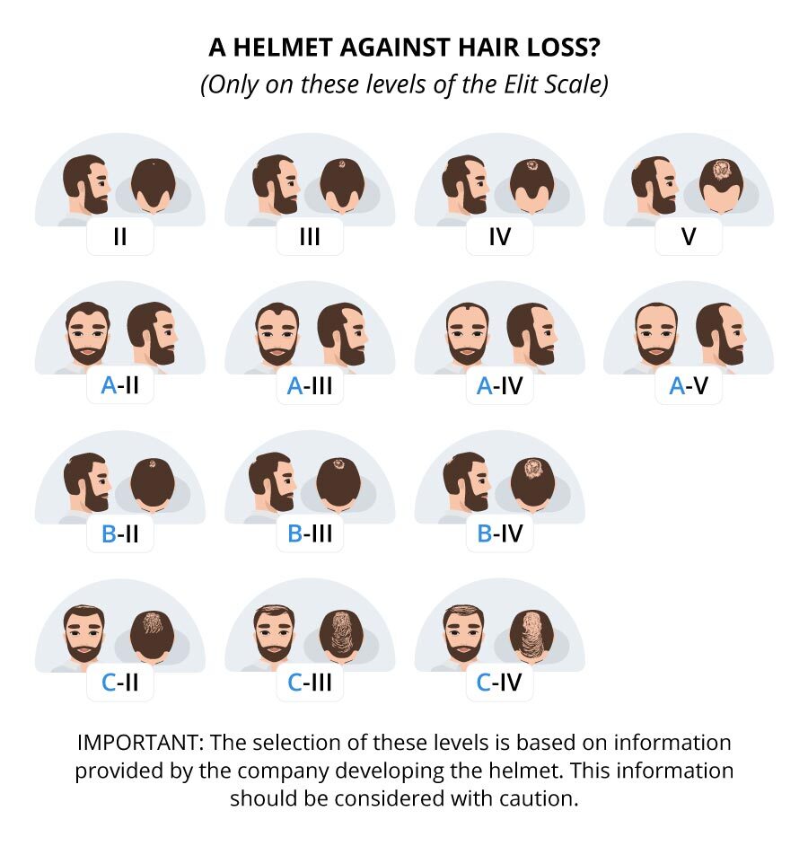 picture of scale for hair loss comparison 