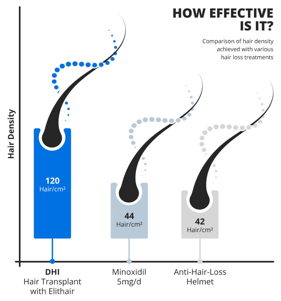 picture of hair density infographic