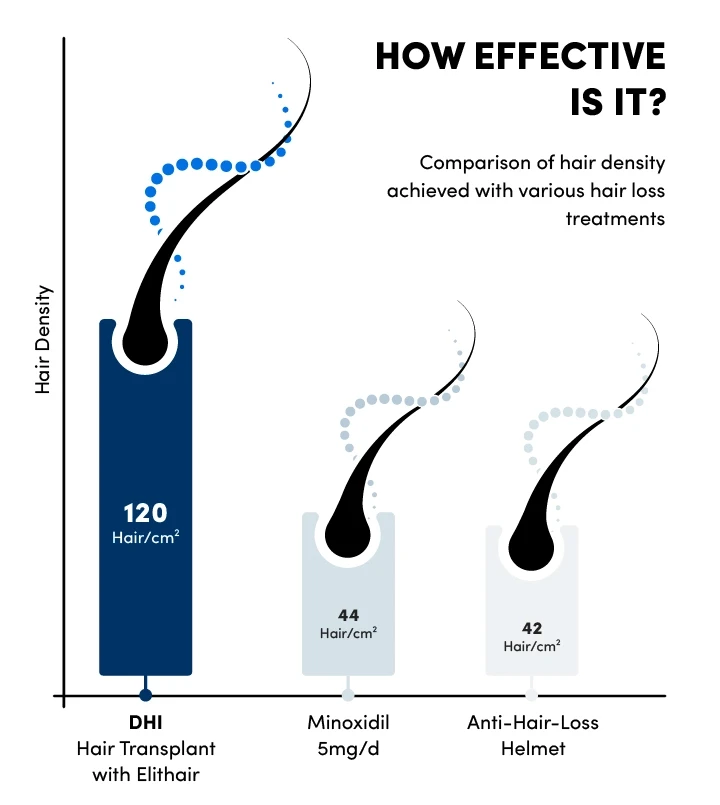Infographic for the Hair density based on three various hair treatments