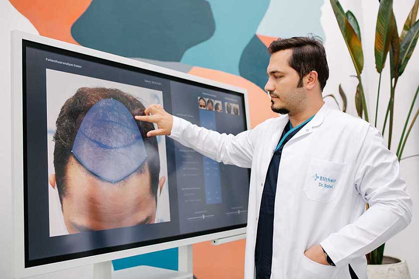 Dr. Balwi during a hair analysis on a big screen after the elit sclae prognosis