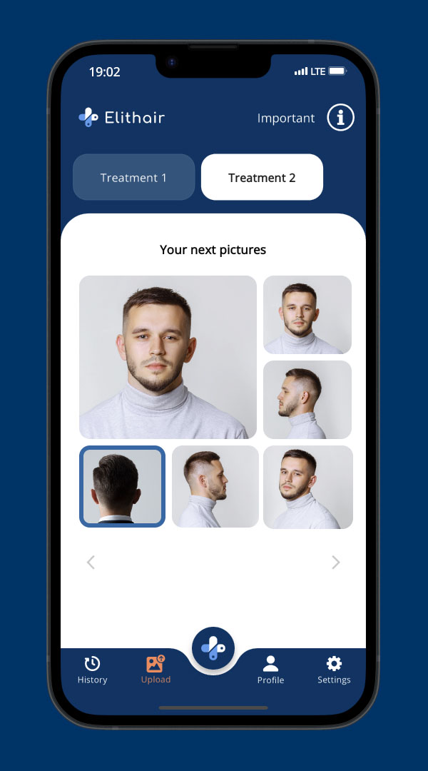 The picture upload screen of the Elithair app