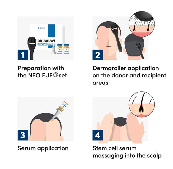Infographic showing the process of using and applying the Elithair NEO FUE treatment