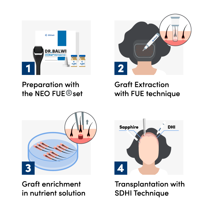 The 4 steps of a hair transplant procedure for women at Elithair