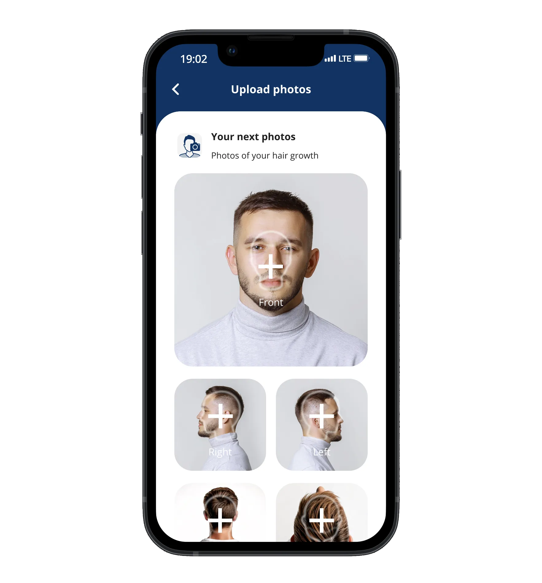 The pictures screen of the Elithair app for hair transplantation