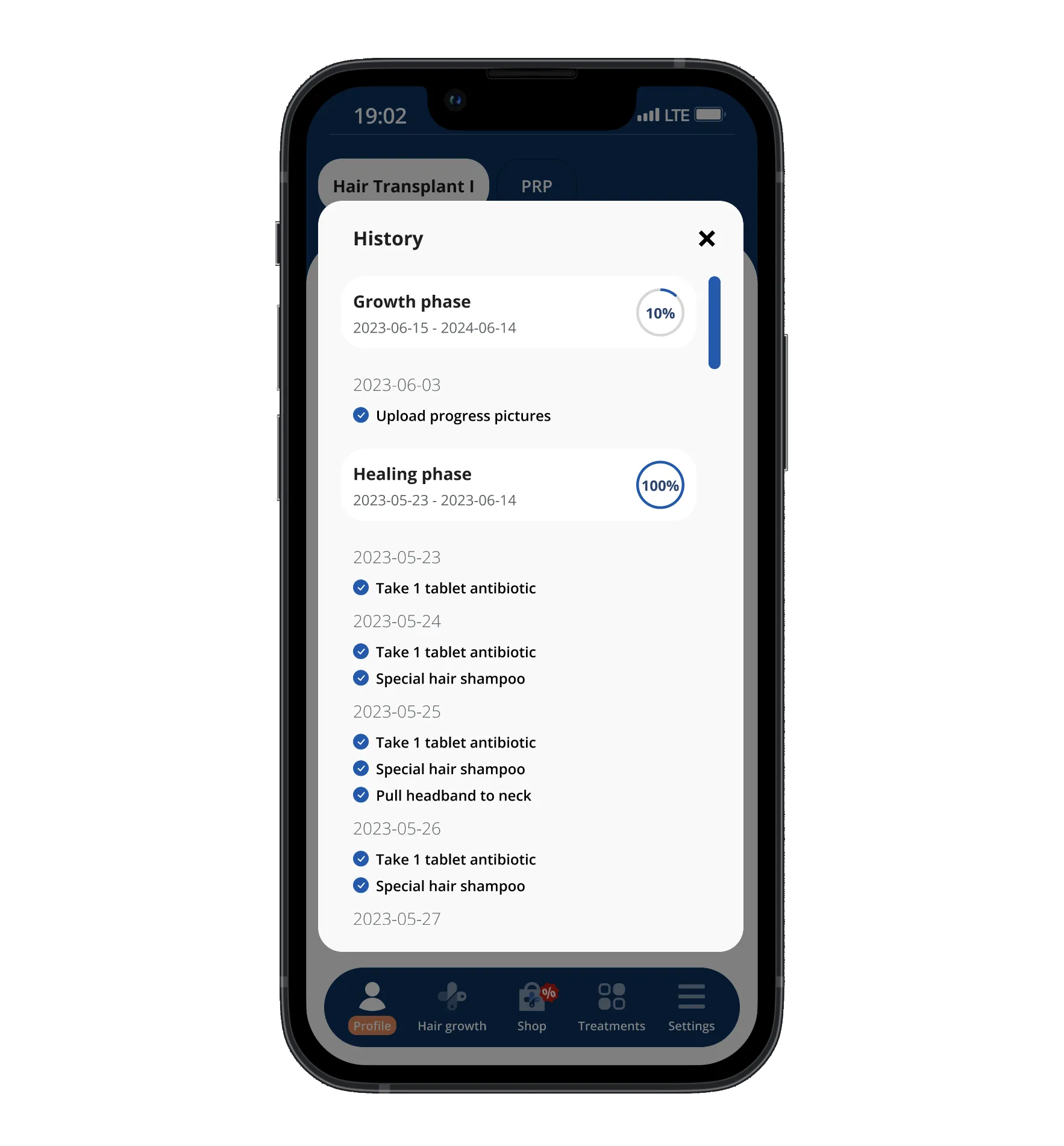 The schedule screen of the Elithair app for hair transplantation