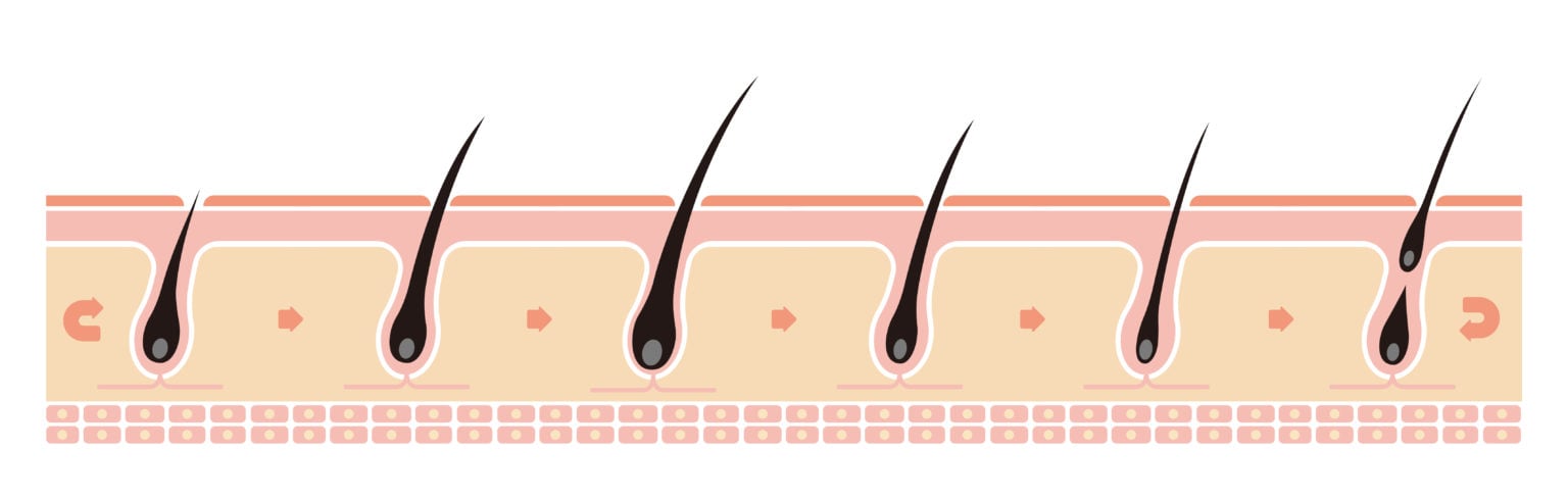 An illustration showing a cross-section of dermal layers and the various phases of the hair cycle across multiple follicles.