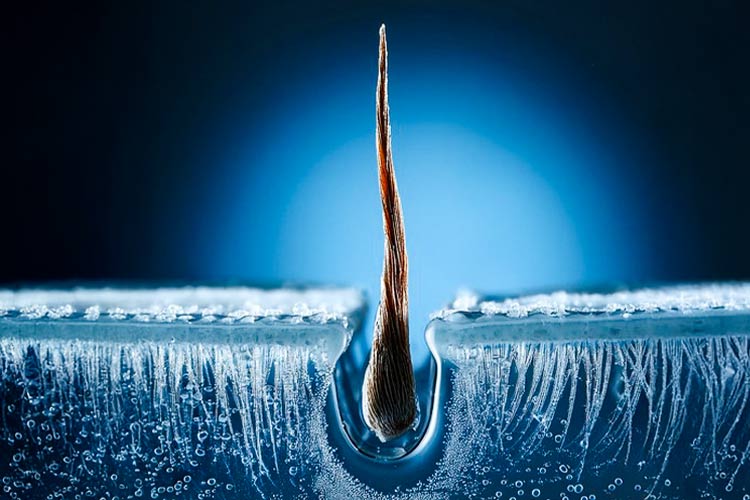 A hair follicle surrounded by ice.