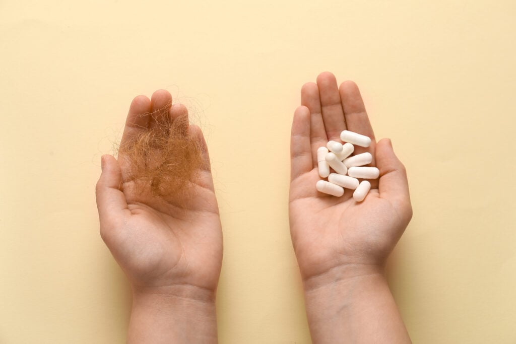 A person holding a clump of shed hair in one hand and MSM pills in the other.