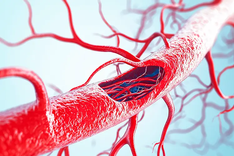 An illustration of blood vessels