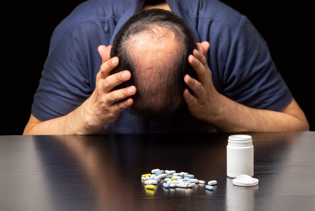 A bald man despairs with a jar of hair loss pills in front of him.