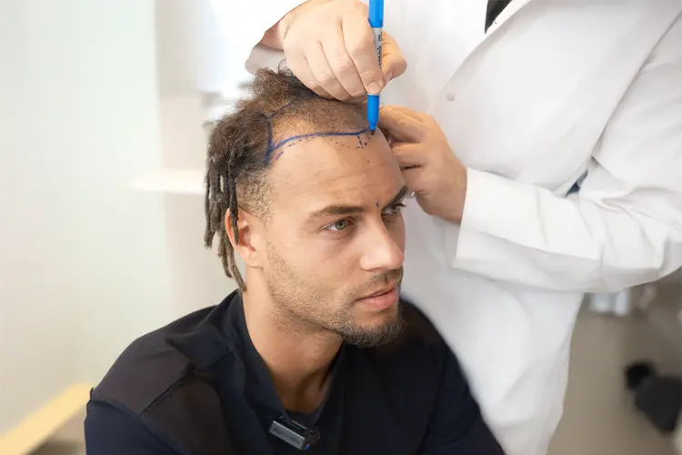 Ouzy See is prepped for a hair transplant by Dr. Balwi.