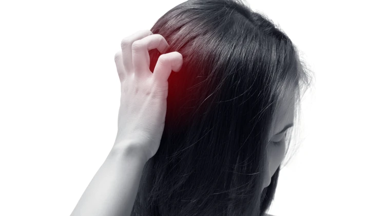 A women scratching her irritated scalp.