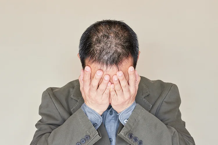 A man with thinning hair buries his head in his hands.