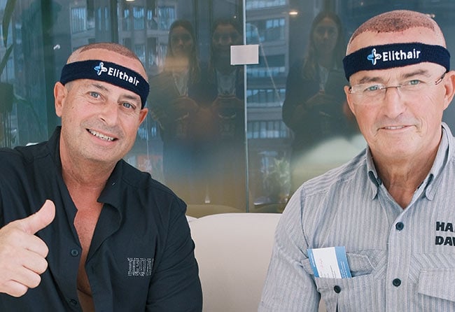 Elithair Patients Satisfied After Hair Transplant