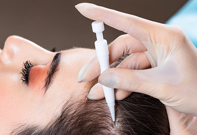 implantation-patient-grafts-percutaneous-technique